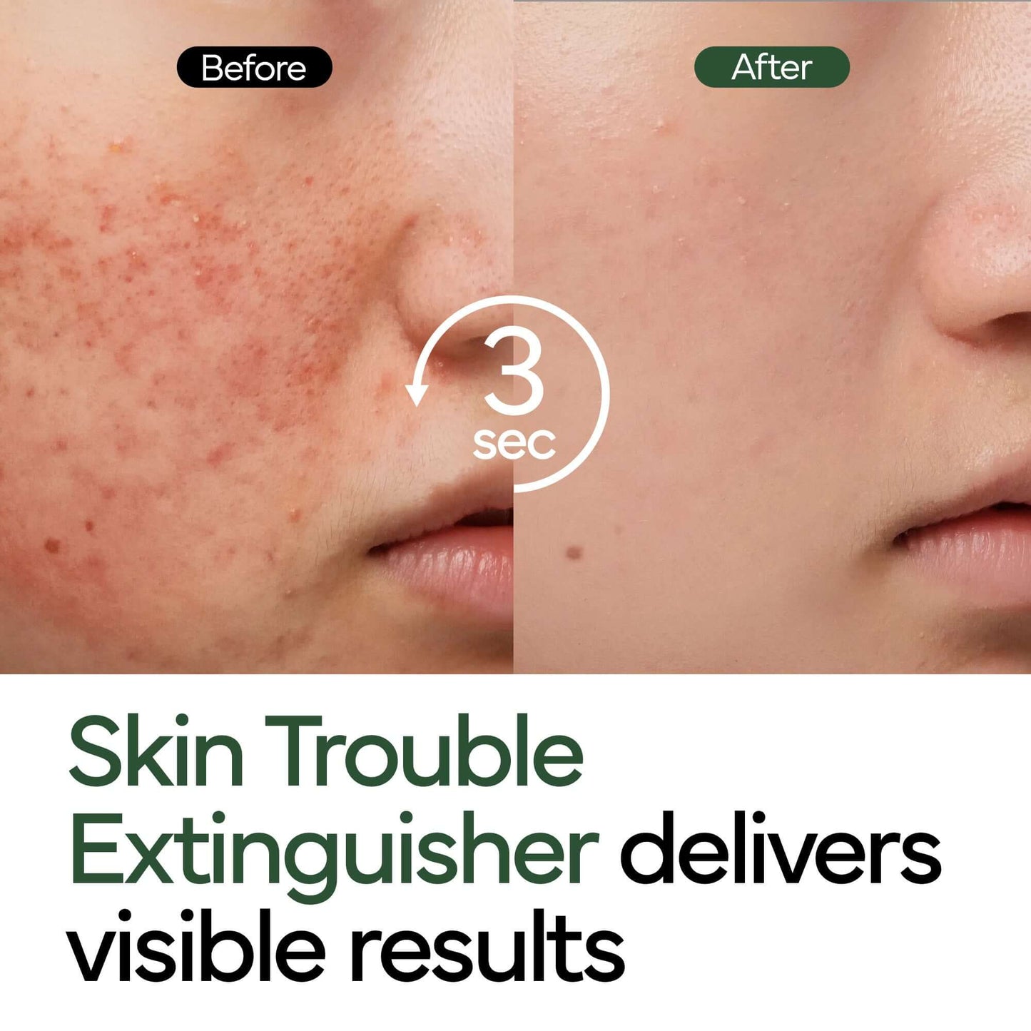 CicaCalm™ Barrier Repair Cream