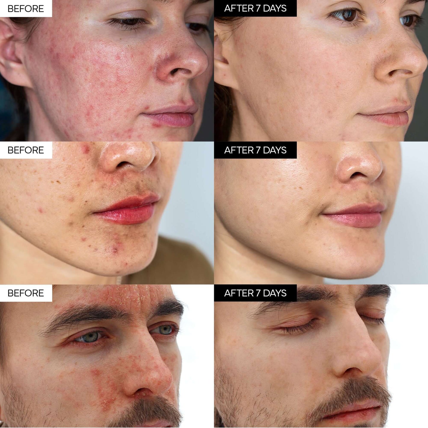 CicaCalm™ Barrier Repair Cream