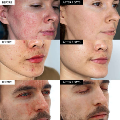 CicaCalm™ Barrier Repair Cream