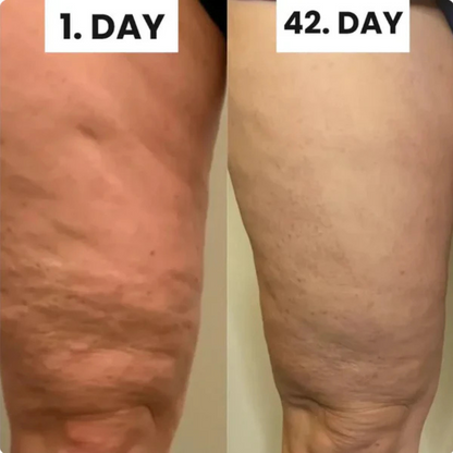 CelluSculpt™ Roller